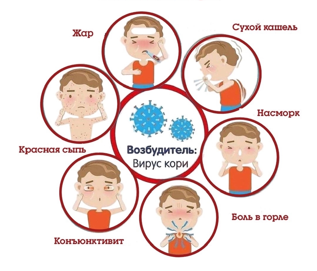 Будьте внимательны к своему здоровью! Лучший способ избежать крайне негативных последствий кори – вовремя пройти  вакцинацию!